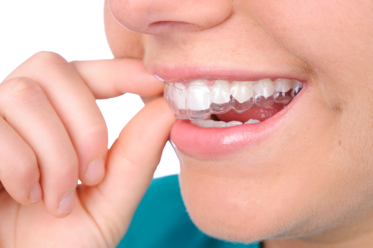 Retainer